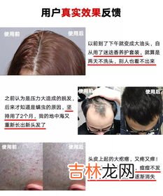 头上为什么会有螨虫呢,头上有螨虫不是没有预兆的,5种现象,说明你的头皮上滋生螨虫