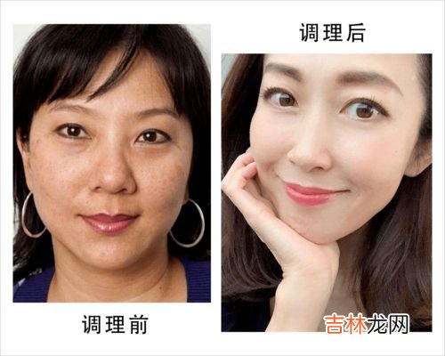 拒绝色斑要改掉的习惯,如何能快速有效的解决皮肤暗黄、色斑?
