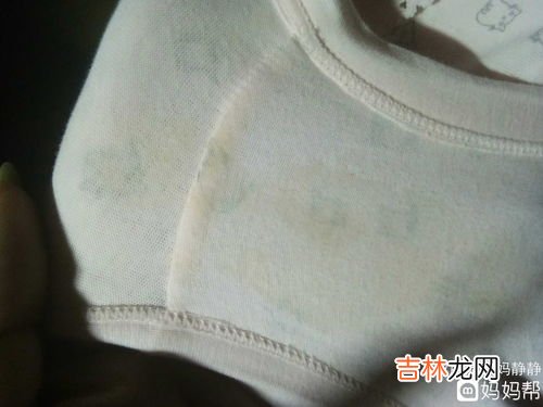 怀孕39周分泌物增多还要多久生,孕39周分泌物增多，大概多久能生？