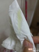 怀孕39周分泌物增多还要多久生,孕39周分泌物增多，大概多久能生？