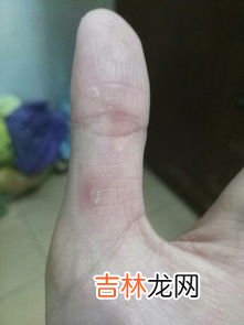水瓶瓶盖打不开怎么办,玻璃瓶盖打不开有啥妙招