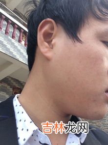 有什么办法不长胡子,怎么样才能让胡子不再长