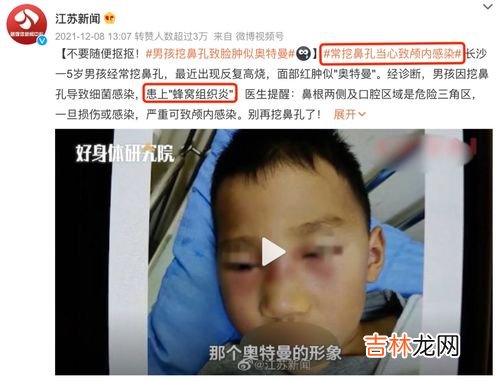 挖鼻孔会带来的不良后果,喜欢挖鼻孔，不是好事！这3个后果，你可能承受不起