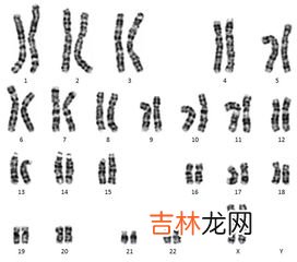 染色体是什么,什么叫染色体