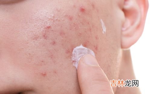 螨虫是什么,什么是螨虫?