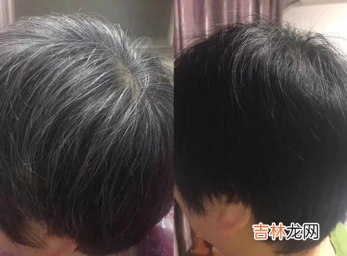 染发后怎么护理和保养,染发后的营养护理