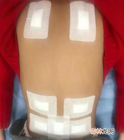 筑骨益高贴真能长高吗,网上说的贴了能够长高的增高贴,真的有用吗?