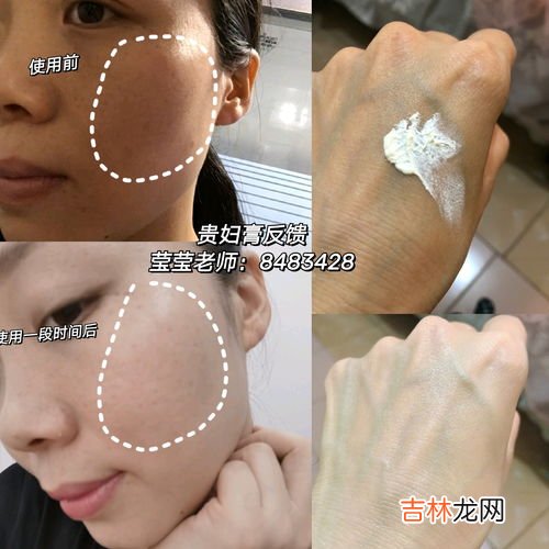 贵妇膏晚上睡觉用不用擦,贵妇膏晚上可以抹在脸睡觉吗