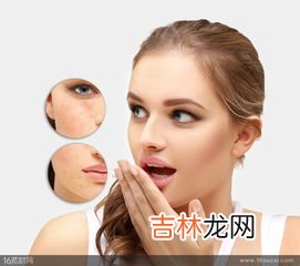 祛痘茶哪个效果好,喝什么茶排毒祛痘?