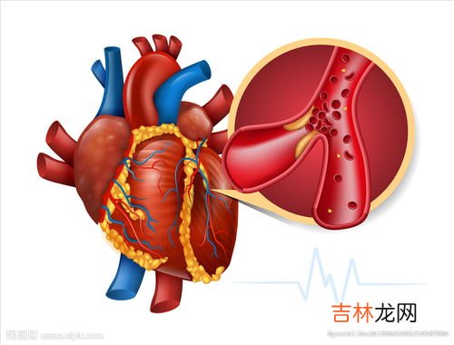 胆固醇高不能吃什么,胆固醇高不能吃什么?