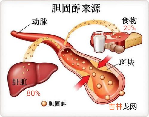 胆固醇高不能吃什么,胆固醇高不能吃什么?