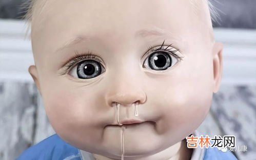 一招止住清鼻涕有什么方法,流清水鼻涕妙招用姜