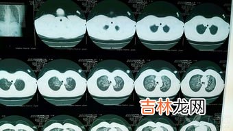 37.5摄氏度 月经期体温37.5,女人月经来了温度会不会有一点高?