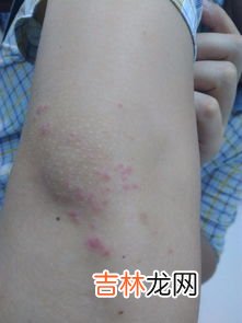 为什么掐胳膊肘不疼,人身上有一处地方不怕掐，随便怎么用力掐，都不痛，你知道这个地方在哪里吗？