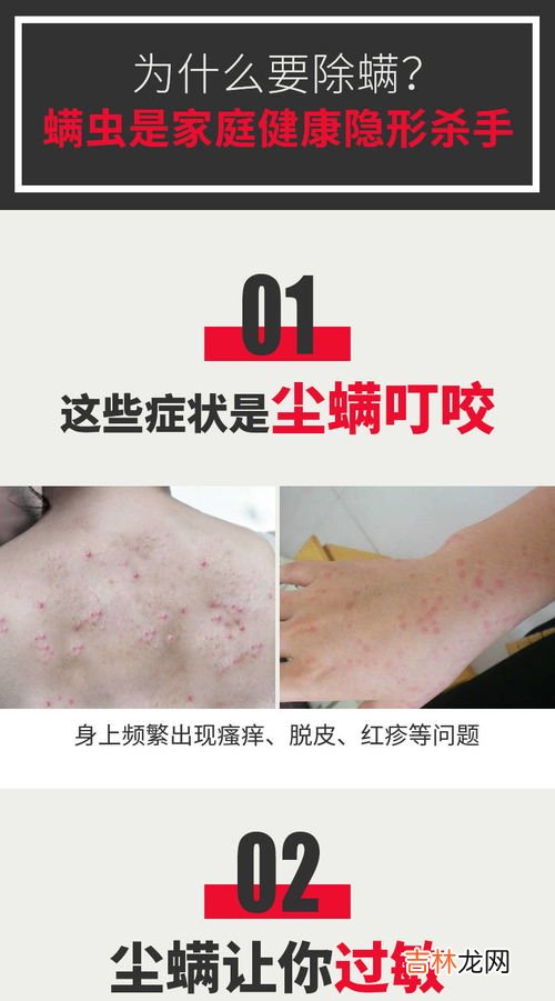 如何除螨虫?床上除螨虫的最快方法,床上的螨虫怎么样彻底清除掉