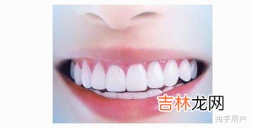 美白牙齿妙招,如何让牙齿变白最简单的方法