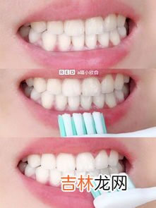 美白牙齿妙招,如何让牙齿变白最简单的方法