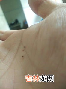 冬天家里有蚊子是怎么回事,冬天家里为什么有蚊子