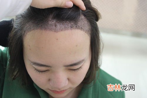 额头高怎么办,额头高，怎么办。有什么方法可以改变？