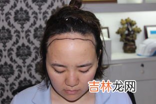额头高怎么办,额头高，怎么办。有什么方法可以改变？