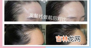 额头高怎么办,额头高，怎么办。有什么方法可以改变？