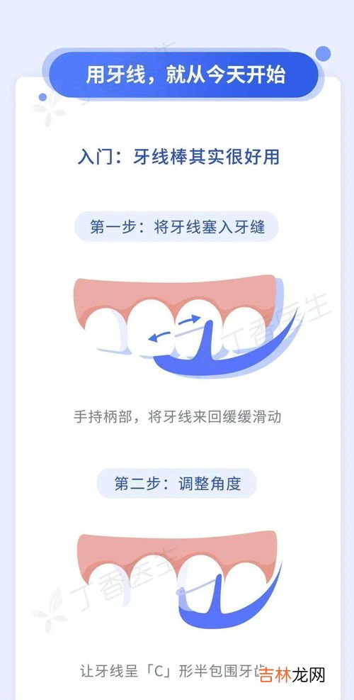 牙线是什么,牙线是什么东西