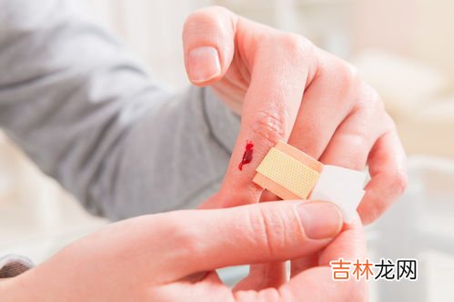 科学处理伤口的原则,各种伤口的处理方法
