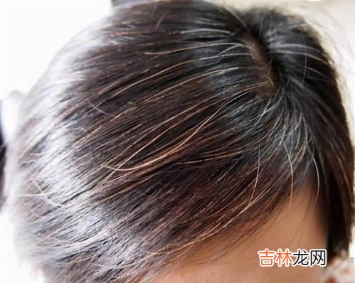 为什么头发能一直长汗毛却长不长,为什么人体的头发、胡须长得很快，腋毛长到一定长度就不再长了？