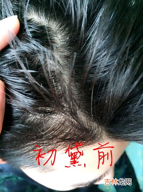 日常护发应该多久洗一次头,头发多长时间洗一次最健康?