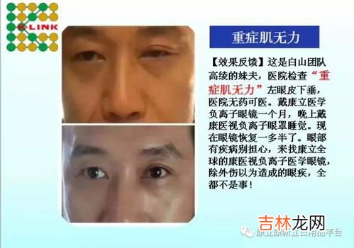 莱芙蔻负离子眼镜有什么作用,负离子眼镜的作用 认识负离子眼镜