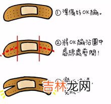 严禁使用创可贴情况,创可贴是不是对人体有害