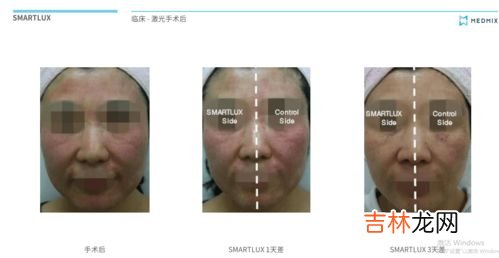 齿痕舌吃什么效果最好呢,齿痕舌怎么调理
