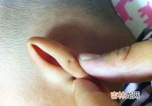怎样防止耳朵进水发炎,游泳时如何预防耳朵进水