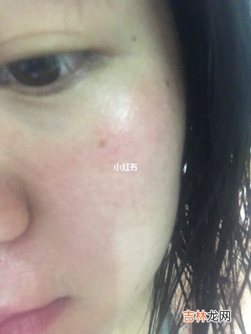 复因皮肤屏障修复乳多少钱,冰溪皮肤屏障修护乳效果怎么样