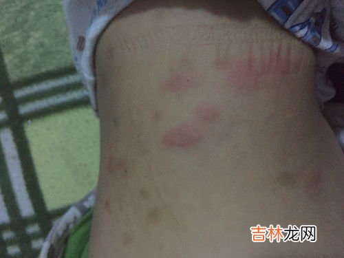 身上老是有静电怎么办,身上老有静电该怎么办