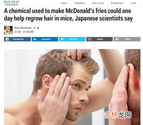 青西丁素能治疗脱发吗,怎么治疗脱发