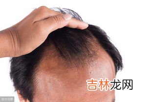 青西丁素能治疗脱发吗,怎么治疗脱发