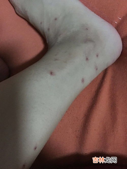 怎样判断床上有臭虫,床上和腿上发现有虫子,如何判断这虫子是不是臭虫?