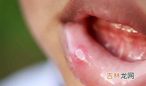维生素不能乱吃,维生素乱补充危害健康?这4点告诉你维生素乱补的危害