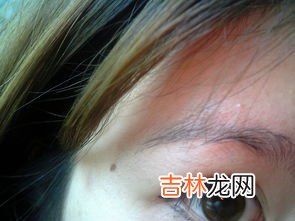 男人下巴有痣代表什么含义,下巴有痣必大富大贵