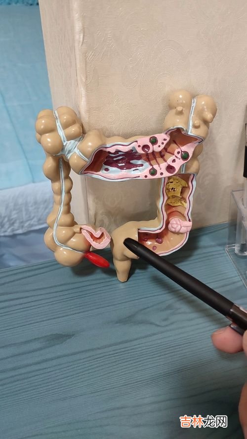 肠胃炎应该些吃什么,肠胃炎吃什么食物好