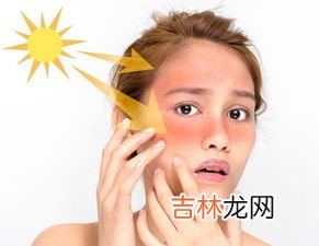 皮肤被晒伤怎样处理,被晒伤的皮肤怎么处理