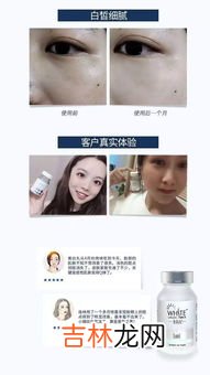 lumi美白丸,美白丸什么牌子好?