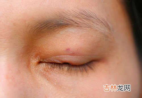 眼皮跳动吉凶之说,右眼皮跳是什么测凶吉