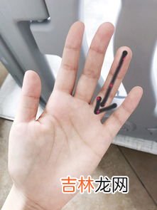 打嗝立竿见影的方法,人为什么会打嗝?快速有效的止嗝方法有哪些?
