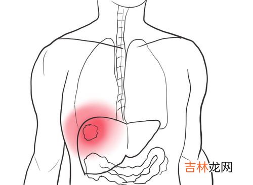 有什么症状就看出肝脏不好,肝不好的人,身体有哪些表现?