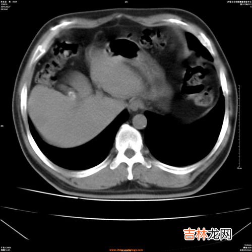 有什么症状就看出肝脏不好,肝不好的人，身体有哪些表现？