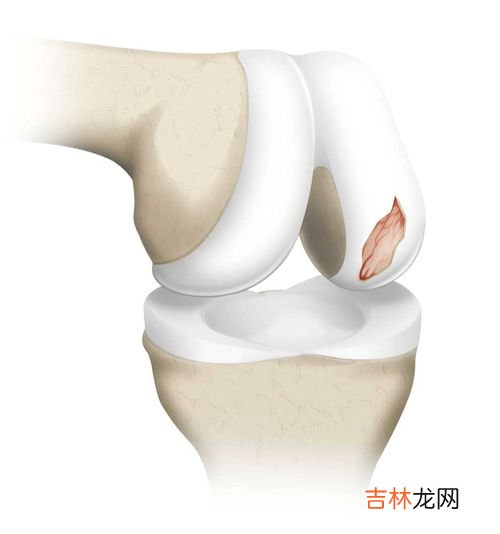 氨糖不能和什么一起吃,吃氨糖可以吃韭菜和菠菜吗