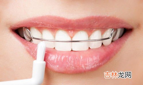 牙齿出血是什么个状况,牙齿出血是什么原因所导致
