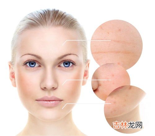 鼻头贴用过以后毛孔会变大吗,鼻子用黑头贴会使毛孔越来越大吗？